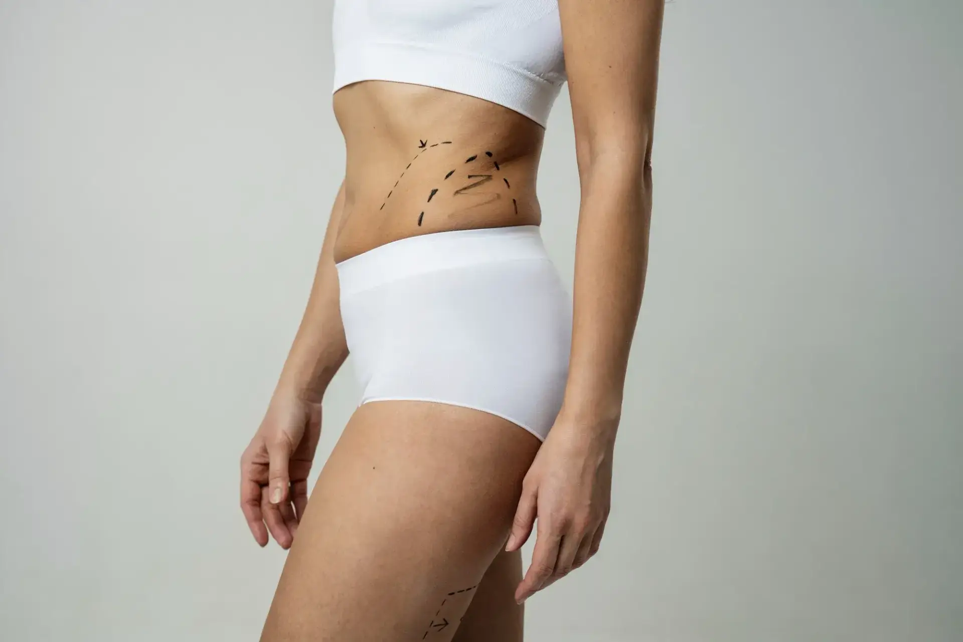 Liposuction in Colombia cost