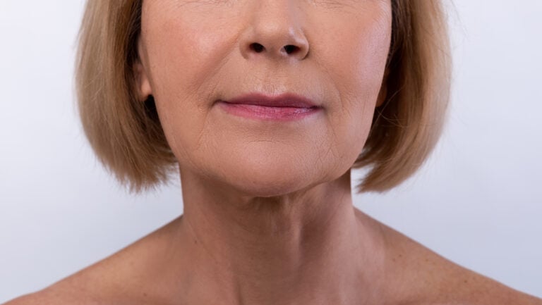 Lip Lift in Istanbul, Turkey by Memorial Hospital 
