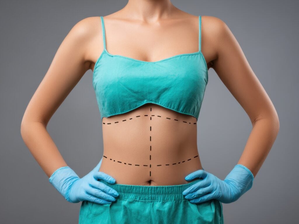 Abdominoplasty (Tummy Tuck) in Playa del Carmen, Mexico by CostaMed Medical Group — Plastic Surgery Procedure in Mexico