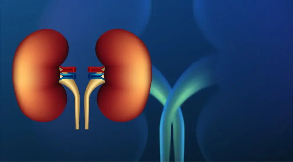 Best Countries for Kidney Transplant