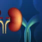 Best Countries for Kidney Transplant