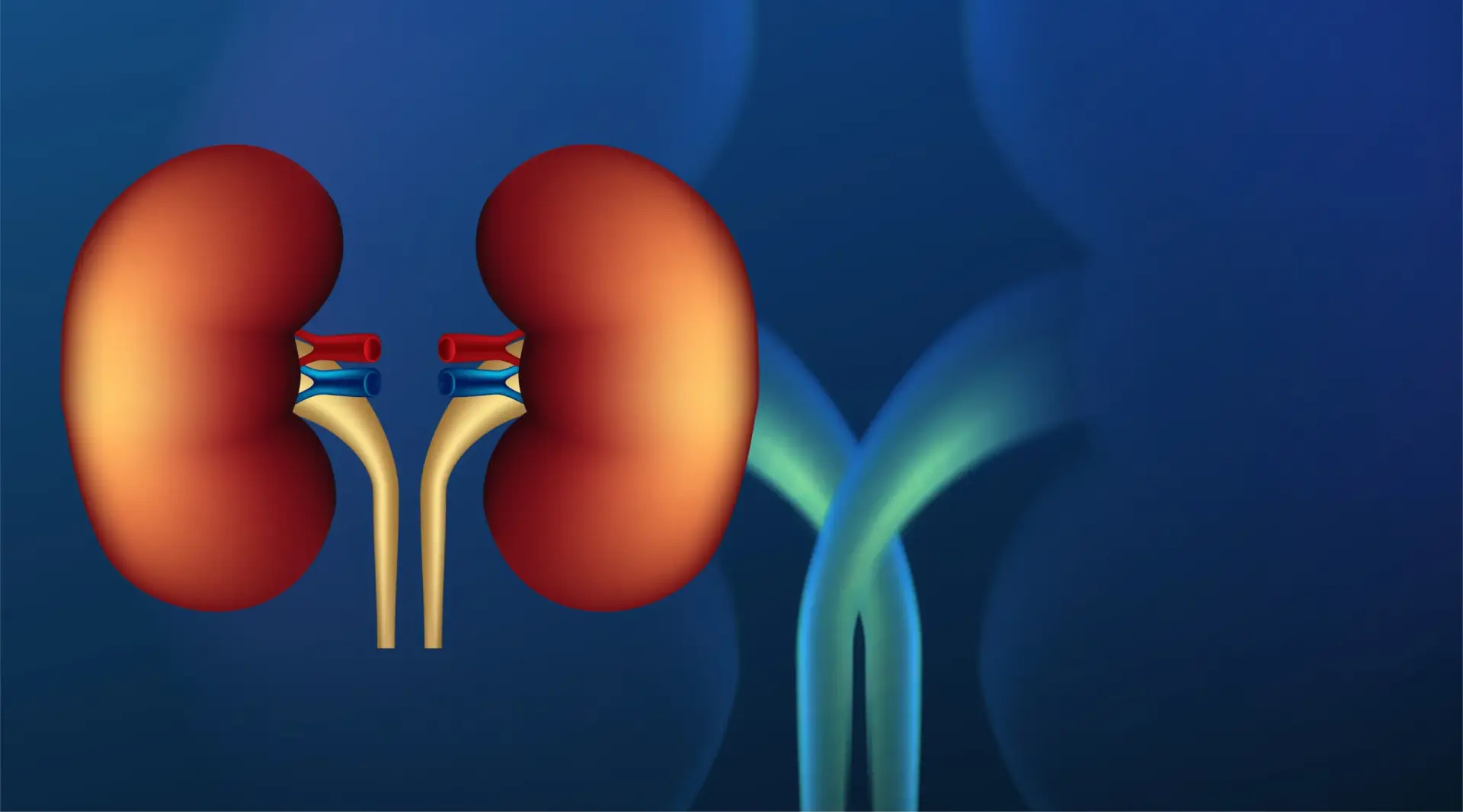 Best Countries for Kidney Transplant