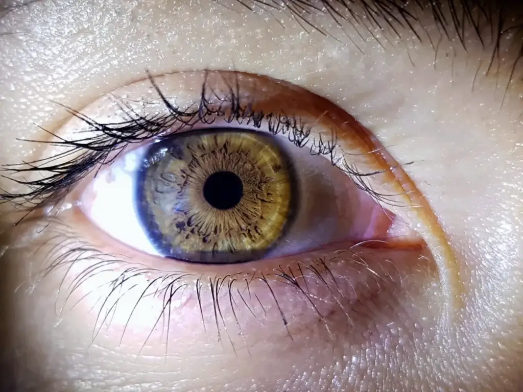 Cheapest Places to Get Laser Eye Surgery