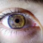 Cheapest Places to Get Laser Eye Surgery