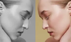 Rhinoplasty in Mexico Cost and Clinics