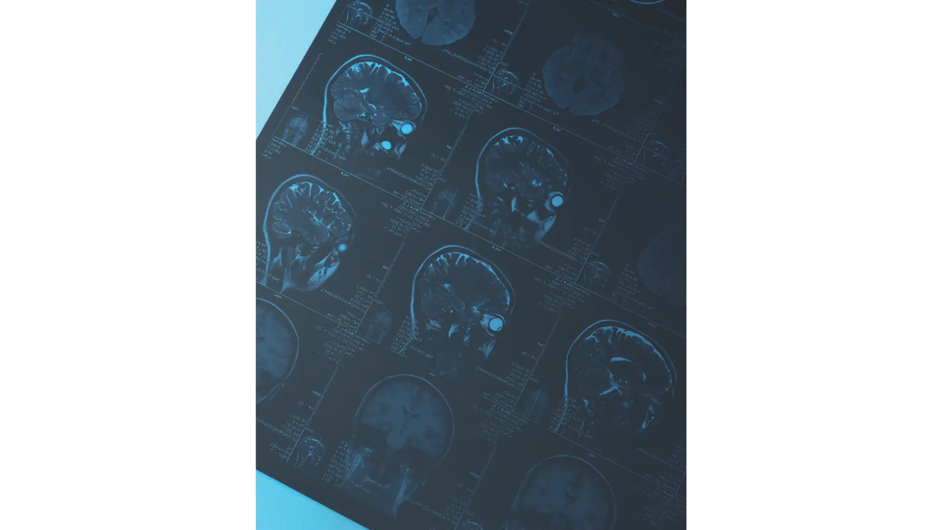 Stem Cells Package in Limassol, Cyprus by Swissmed Health