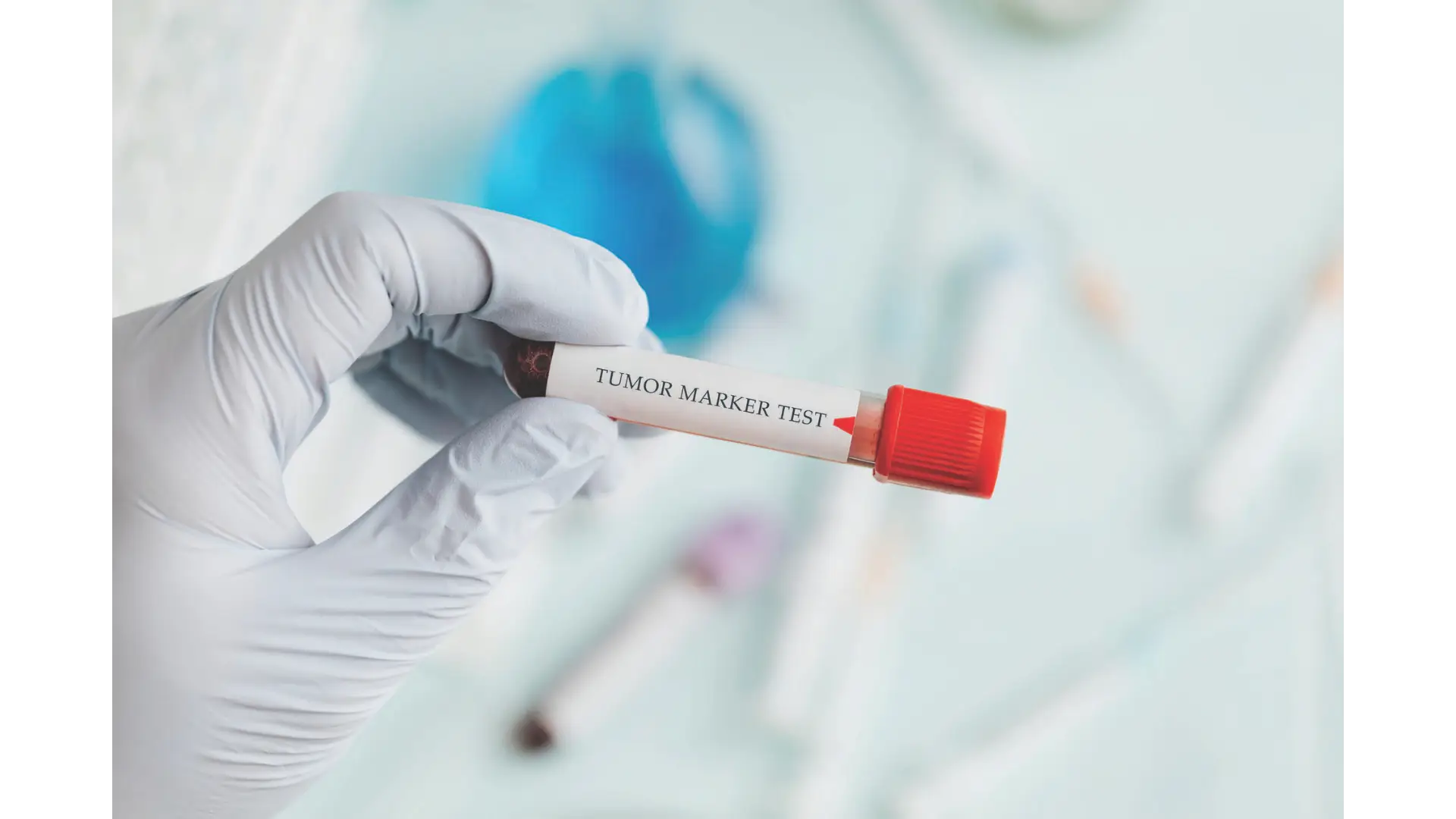 Cancer Protocol Package in Limassol, Cyprus by Swissmed Health