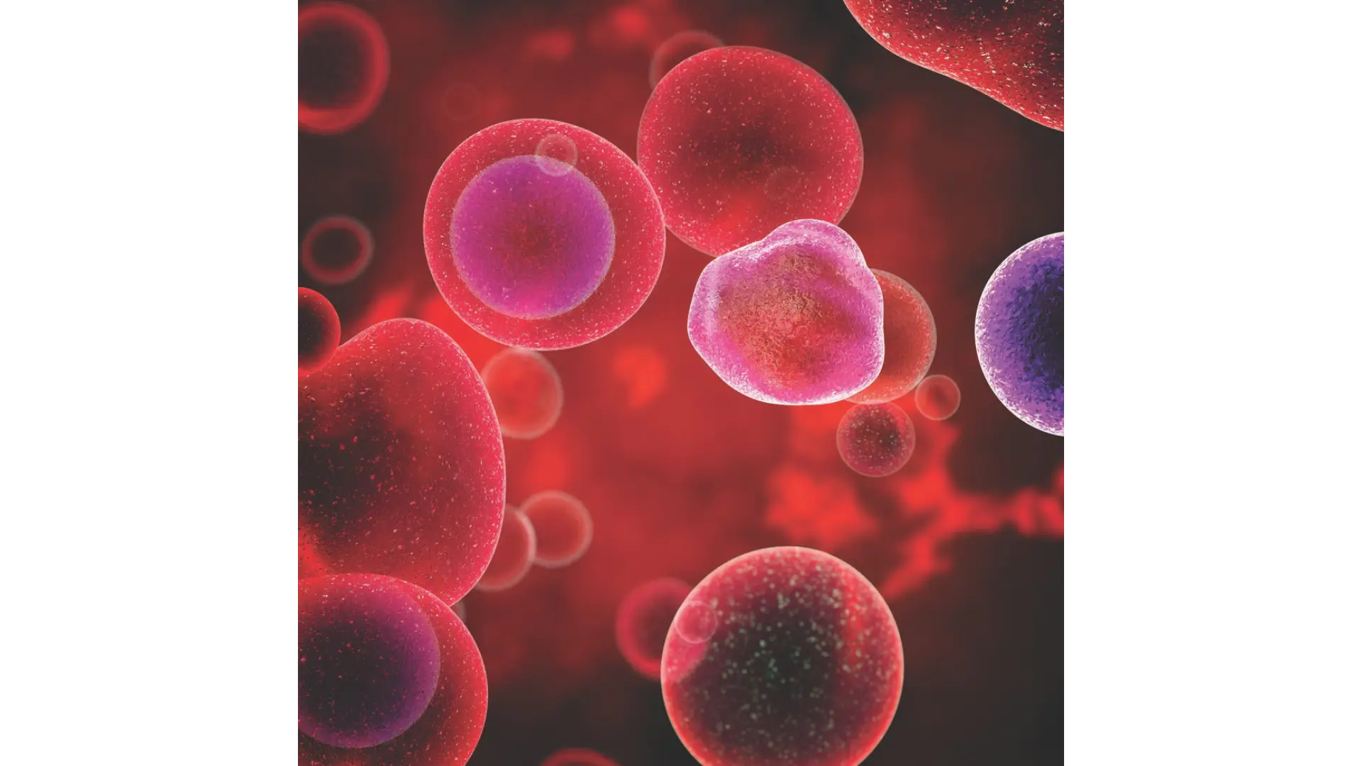 Cancer Protocol Package in Limassol, Cyprus by Swissmed Health