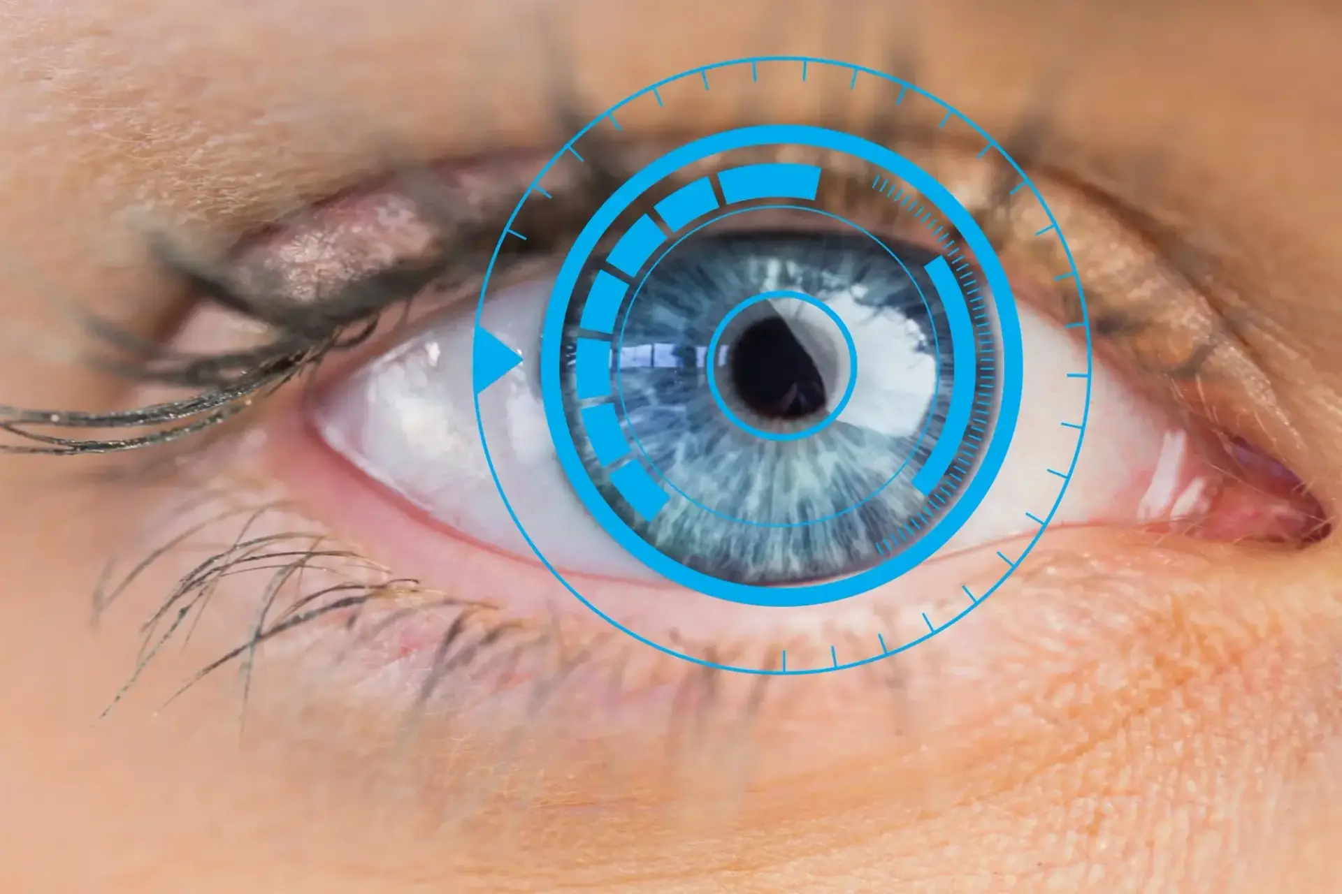 Artificial Eye Fitting in Dubai