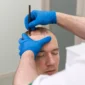 DHI Hair Transplantation in Turkey Cost