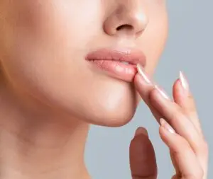 Lip Lift in Istanbul, Turkey by Dr. Gurkan Kayabasoglu