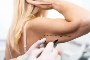 Arm Lift in Mexico Cost and Clinics