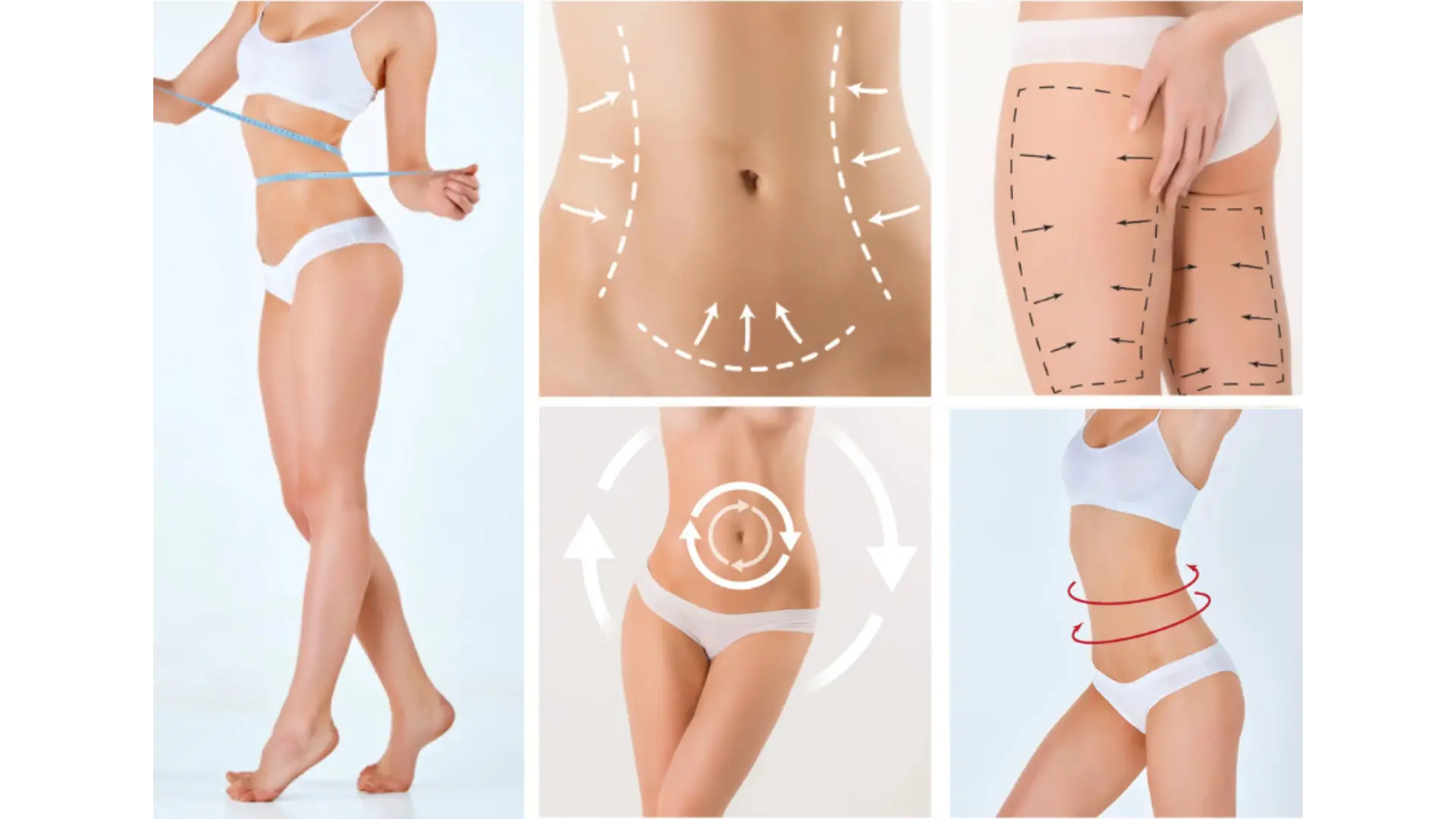 Non-Surgical Body Shaping in Mexico City, Mexico by Jose Cortes Institute