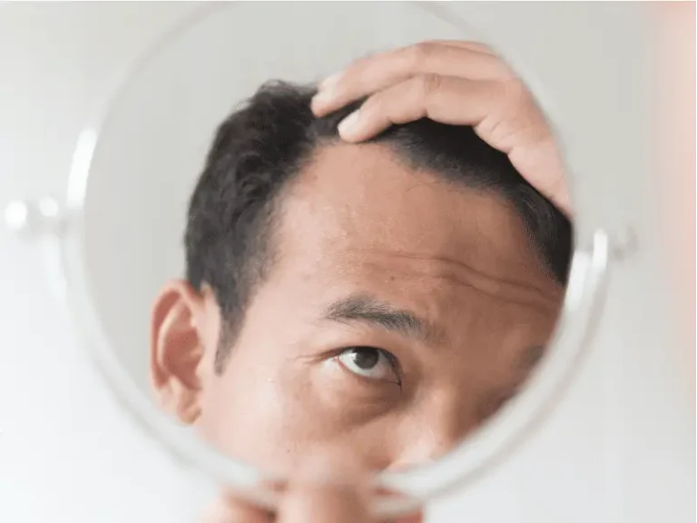 Hair Restoration in Osaka, Japan by Cell Grand Clinic — Hair Restoration Surgery Procedure in Japan