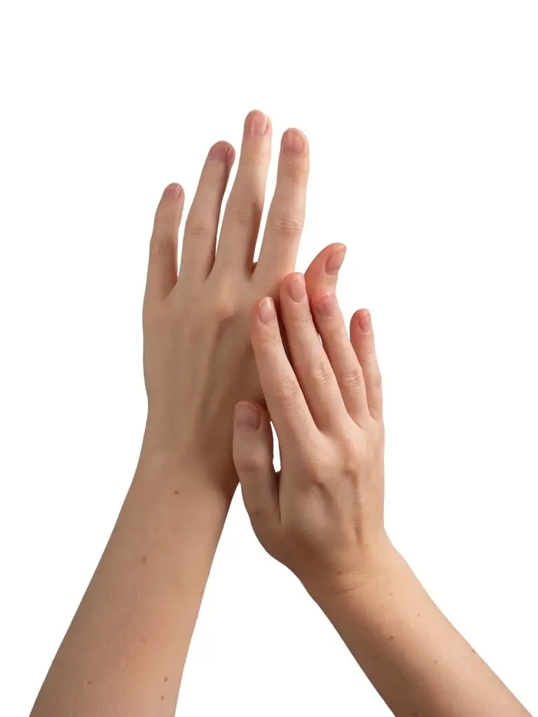 Hand Rejuvenation in Mexico City, Mexico by Jose Cortes Institute