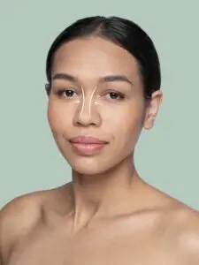 Rhinoplasty Surgery in Seoul, South Korea by Asan Medical Center