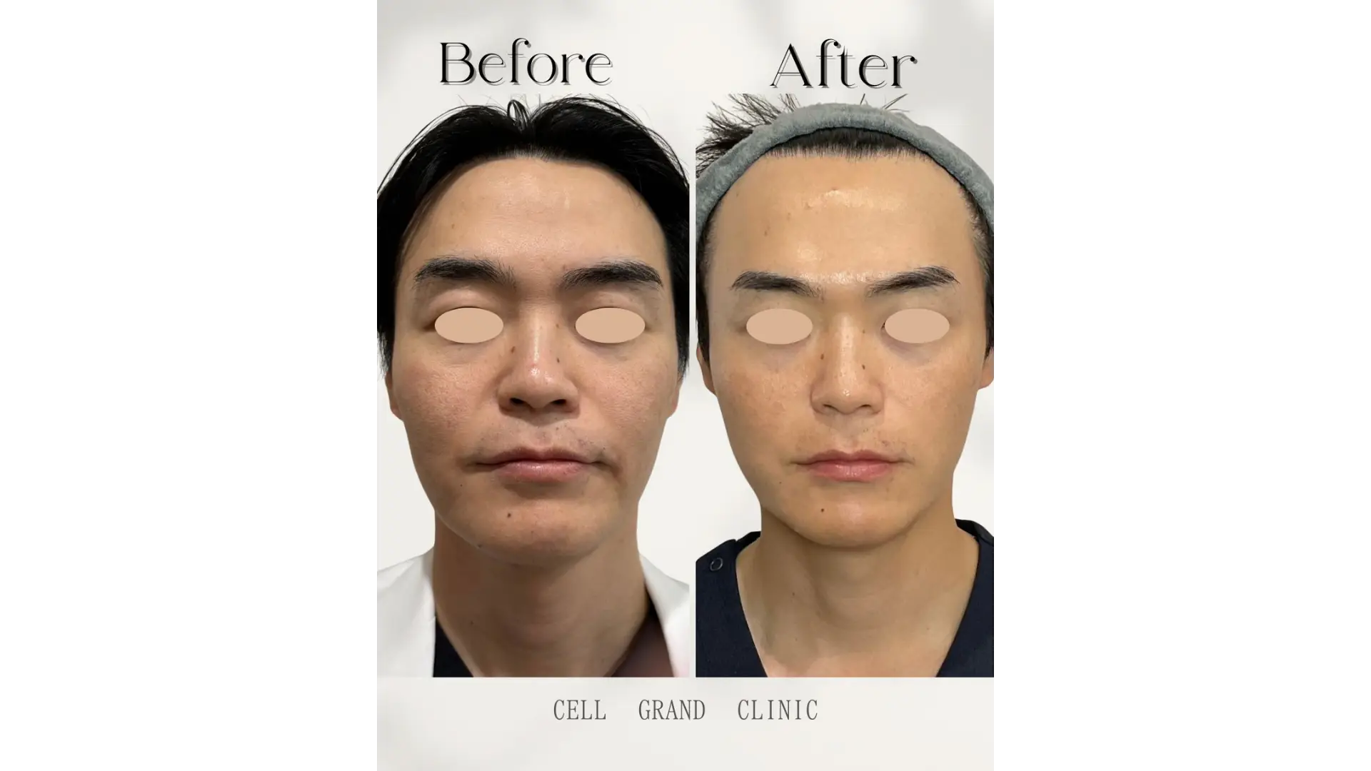 Anti Aging in Osaka, Japan by Cell Grand Clinic