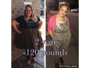 Gastric Sleeve Surgery in Tijuana, Mexico by Hospital BCN — Weight Loss Surgery in Mexico