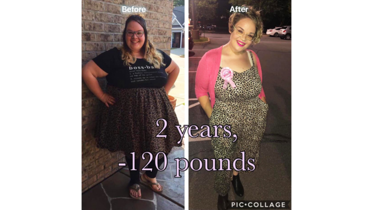 Gastric Sleeve Surgery in Tijuana, Mexico by Hospital BCN