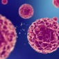 Big Cyst Operation in Turkey Cost