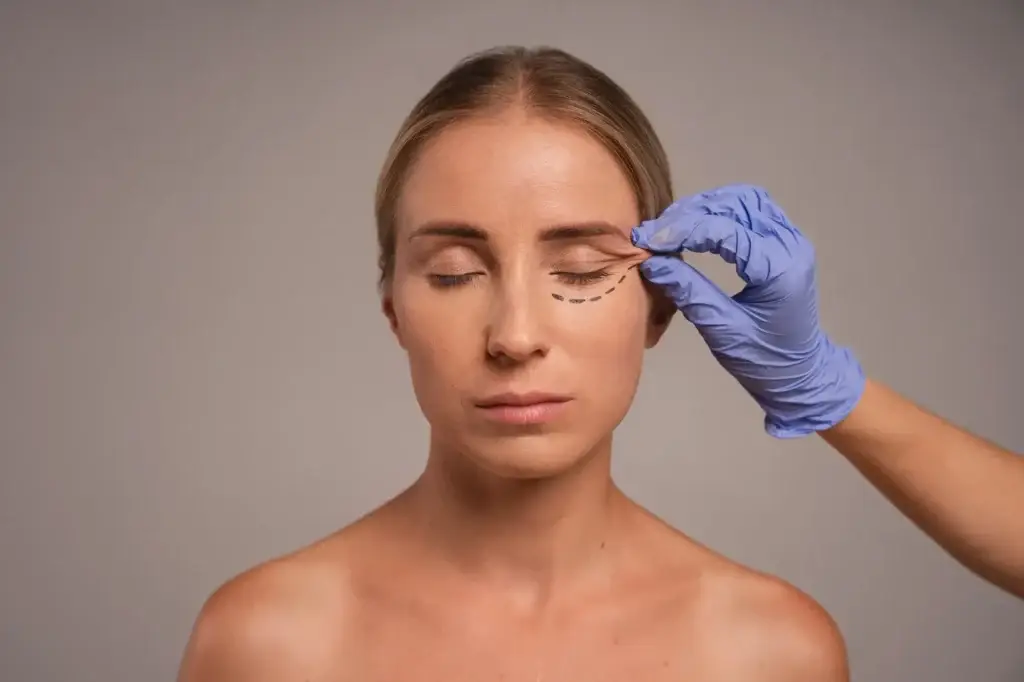 Blepharoplasty Revision in South Korea Cost and Clinics