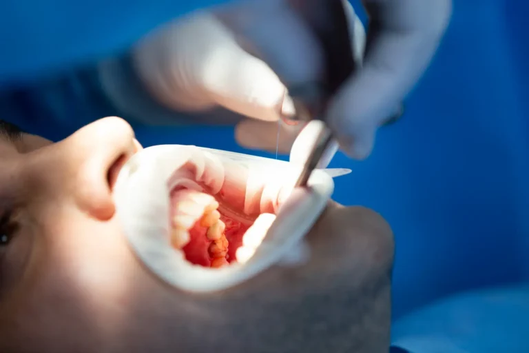Bone Grafting in Turkey Cost and Clinics