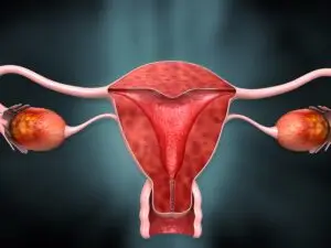 HSG (Hysterosalpingography) in Famagusta, Cyprus by Cyprus IVF Hospital — Fertility in Cyprus