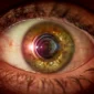 Keratoconus Treatment in Dubai UAE