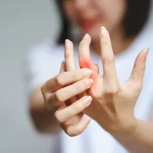 Rheumatoid Arthritis (RA) Treatment with Stem Cells in Medellín, Colombia by StemCell Colombia