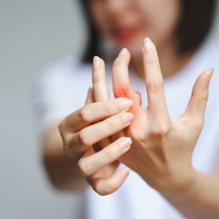 Rheumatoid Arthritis (RA) Treatment with Stem Cells in Medellín, Colombia by StemCell Colombia