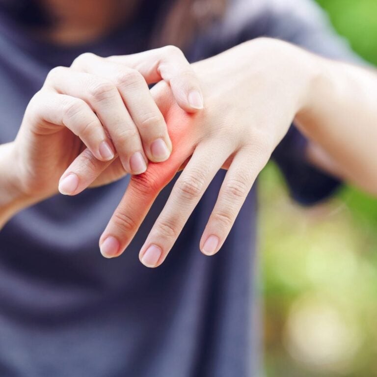 Psoriatic Arthritis Treatment with Stem Cells in Medellín, Colombia by StemCell Colombia