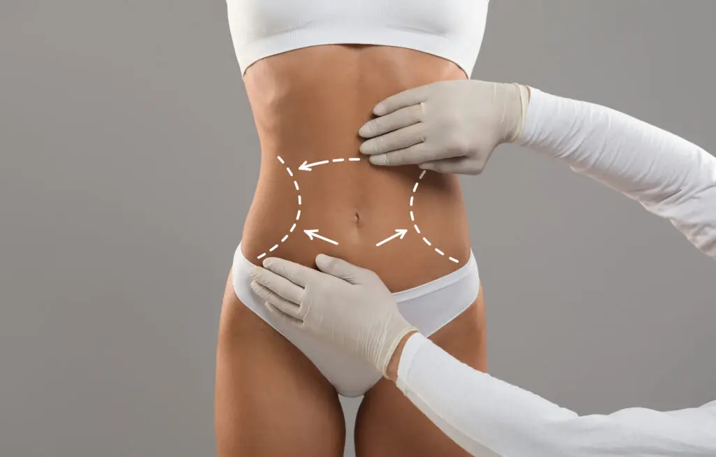 Gastric Bypass Surgery (Roux-en-Y) in Istanbul, Turkey by Medical Park Hospitals — Weight Loss Surgery Procedure in Turkey