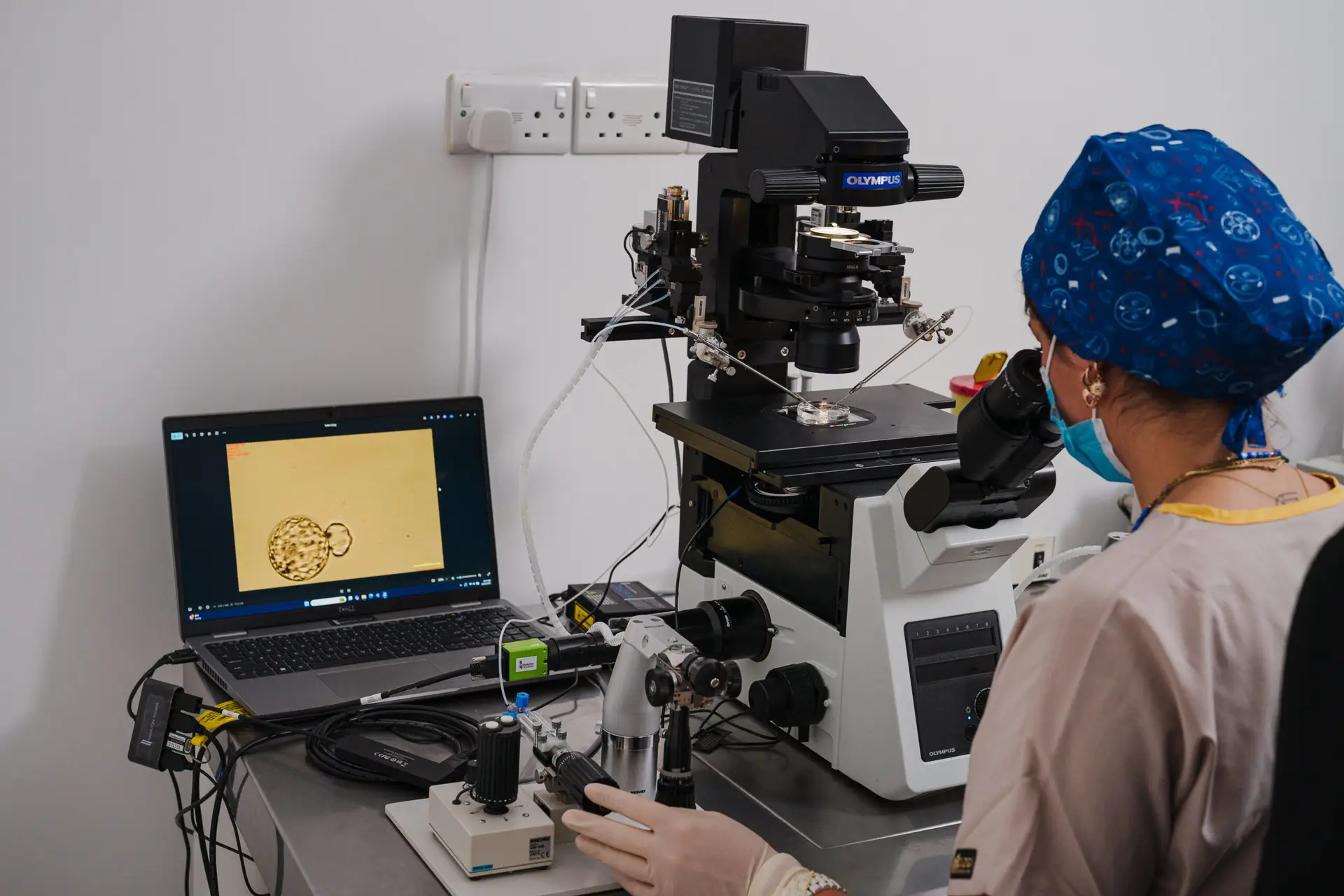 Egg Freezing in Famagusta, Cyprus by Cyprus IVF Hospital