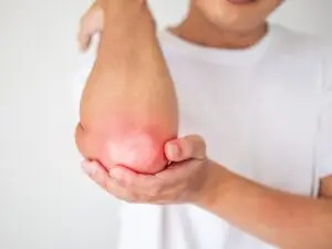 Elbow Treatment with Stem Cells in Medellín, Colombia by StemCell Colombia — Stem Cell Treatment in Colombia