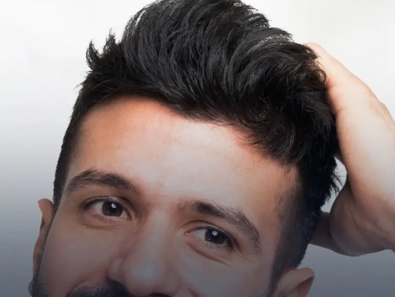 FUE Hair Transplant in Istanbul, Turkey by Avicenna Hospital — Hair Restoration Surgery Procedure in Turkey