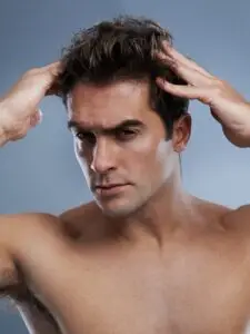 CHOI (DHI) Hair Transplant in Istanbul, Turkey by Avicenna Hospital