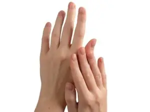 Hand Rejuvenation in Mexico City, Mexico by Jose Cortes Institute — Dermatology in Mexico