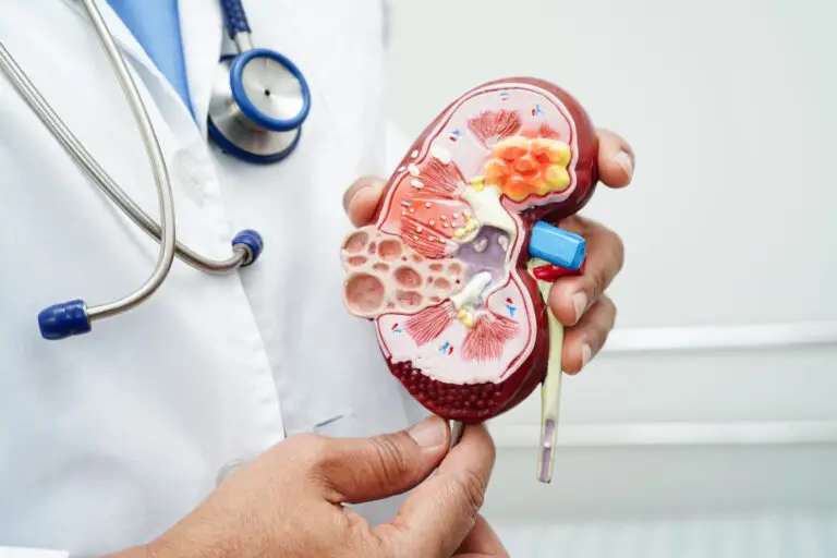 Polycystic Kidney Disease Treatment in Istanbul, Turkey by Avicenna Hospital — Nephrology Procedure in Turkey