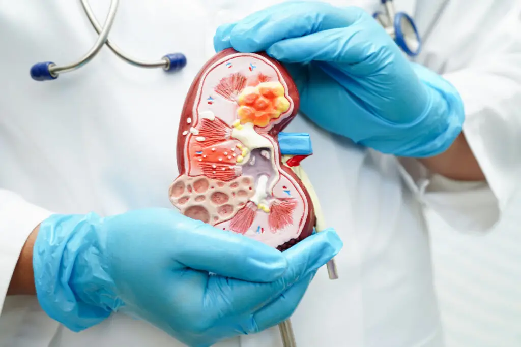 Kidney Failure (Acute and Chronic) Treatment in Istanbul, Turkey by Avicenna Hospital — Nephrology Procedure in Turkey
