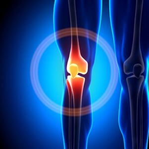 Knee Treatment with Stem Cells in Medellín, Colombia by StemCell Colombia — Stem Cell Treatment in Colombia