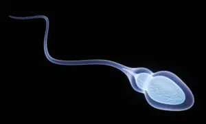 Sperm Freezing in Famagusta, Cyprus by Cyprus IVF Hospital