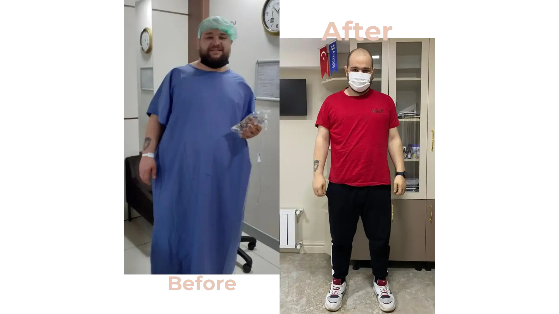Gastric Bypass Surgery in Istanbul, Turkey by Avicenna Hospital