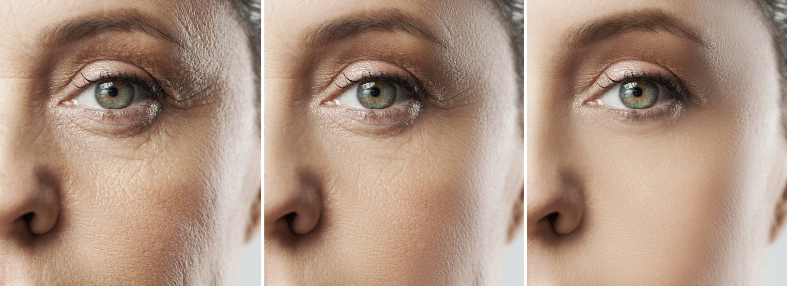 Anti-Aging Treatment with Stem Cells in Malacky, Slovakia by CellCenter Slovakia — Procedure Gallery Photo