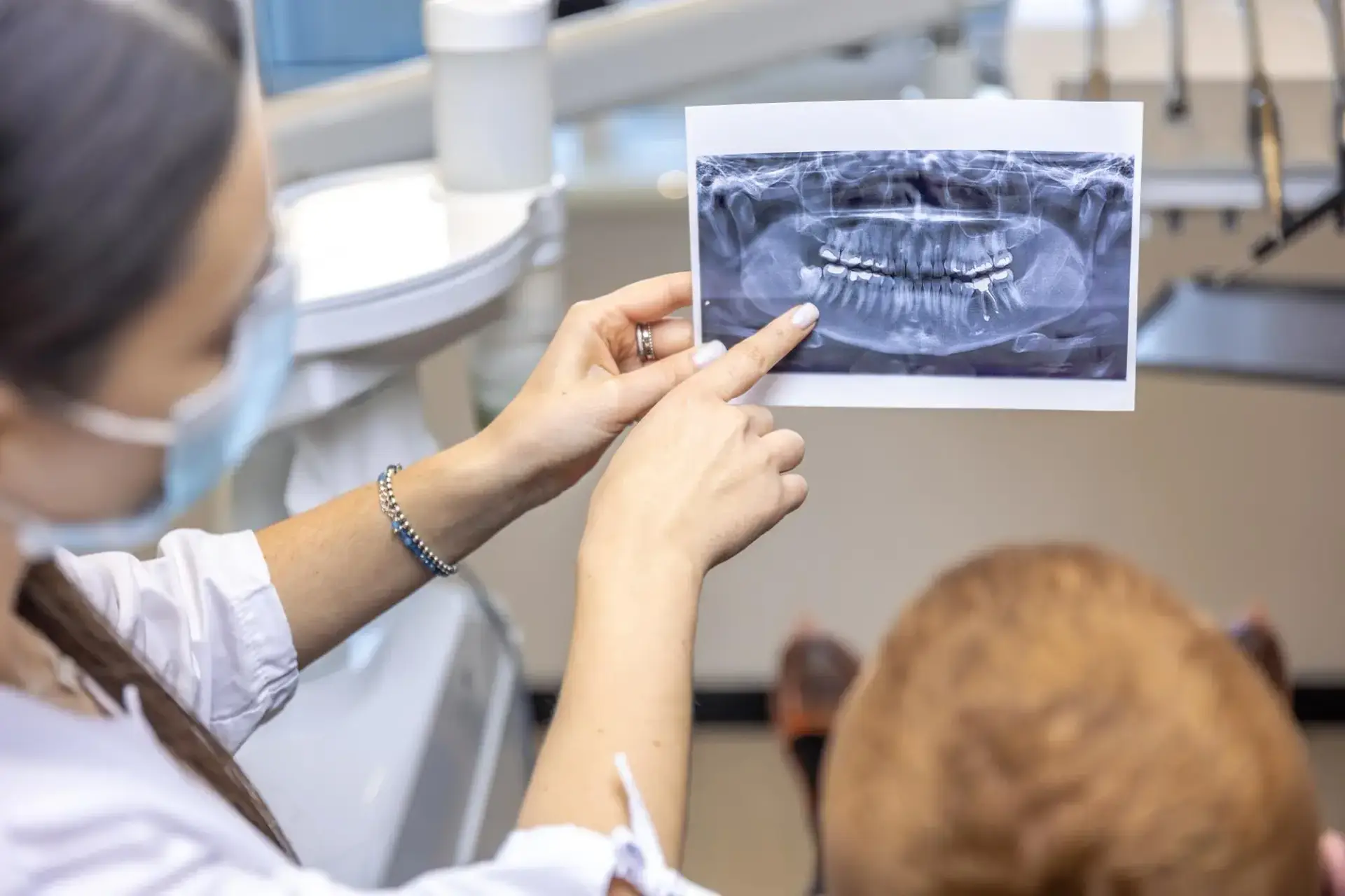 Block Bone Graft in Colombia Cost