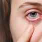 Corneal Abrasions in Dubai Cost