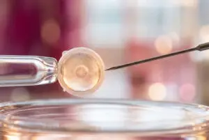 Embryo Implantation Failures Treatment Clinics and Procedures Abroad