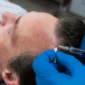 Hair Transplant in Morocco Cost