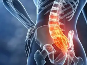 Lumbar pain (Back pain) Treatment with Stem Cells in Medellín, Colombia by StemCell Colombia — Stem Cell Treatment in Colombia