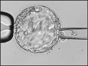 Preimplantation Genetic Testing (PGT) Clinics and Procedures Abroad