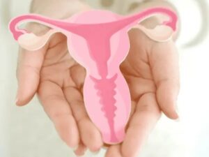 Endometriosis Treatment in Athens, Greece by Ovagenesis — Gynecology in Greece
